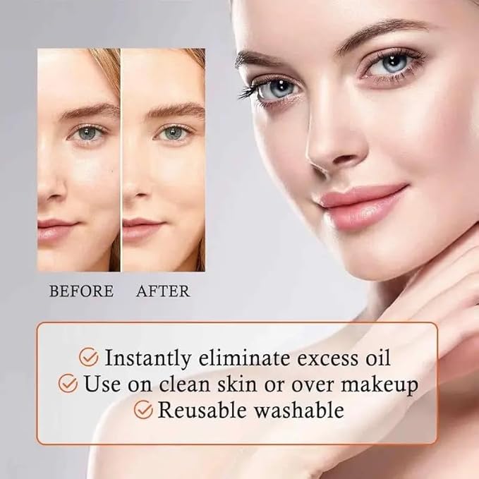 Oil-Absorbing Volcanic Face Roller set with blotting paper (White Set)