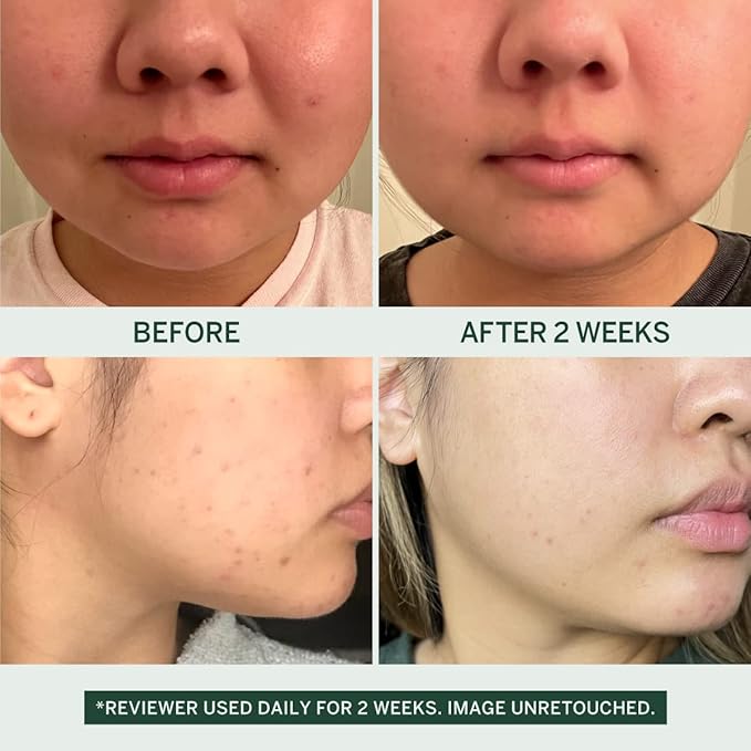 Urban Calm Collection - Fermented Skincare Anti-Aging