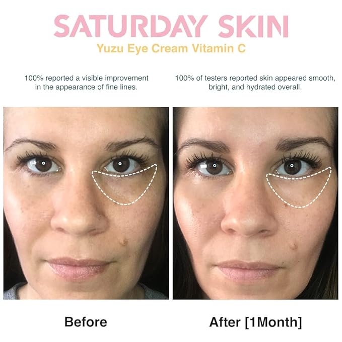 Saturday Skin Yuzu Eye Balm Vitamin lluminating