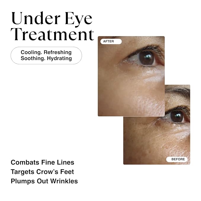 Matkas korean retinol eye cream