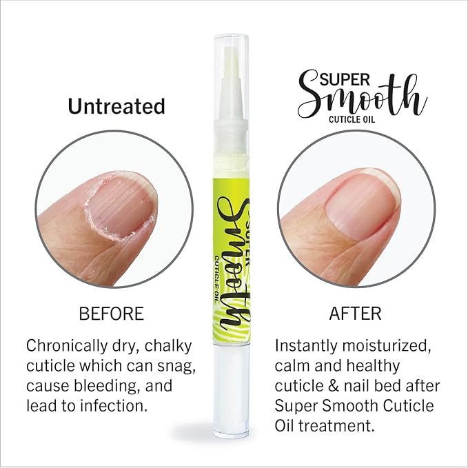 Cuticle Oil for Nails –