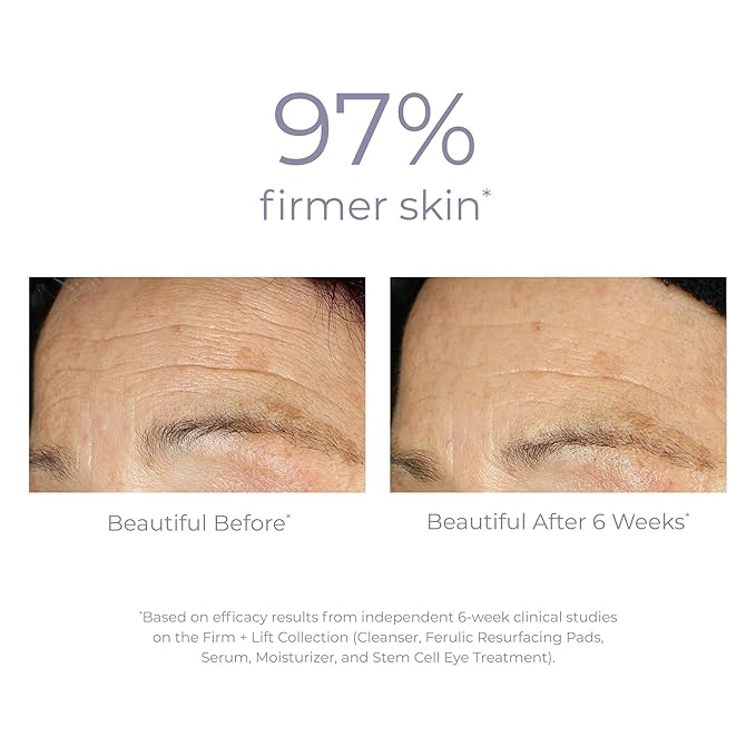 DERMA E Ultra Lift DMAE Concentrated Serum – All Natural Skin Firming & Hydrating Serum with Copper Peptides and Resveratrol – Concentrated Facial Skin Care, 1oz