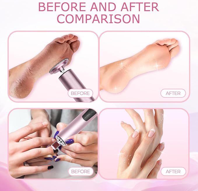 krofaue Electric Callus Remover for