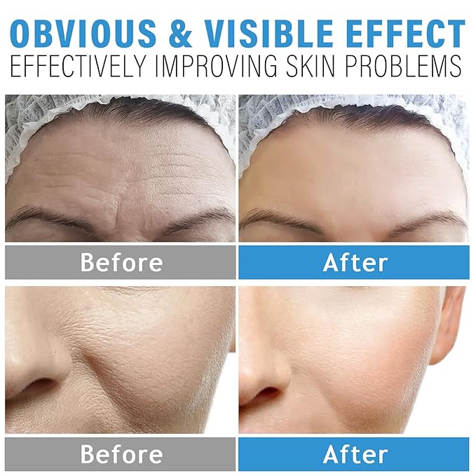 Collagen Face Mask, Anti-Aging Bio-Collagen Real