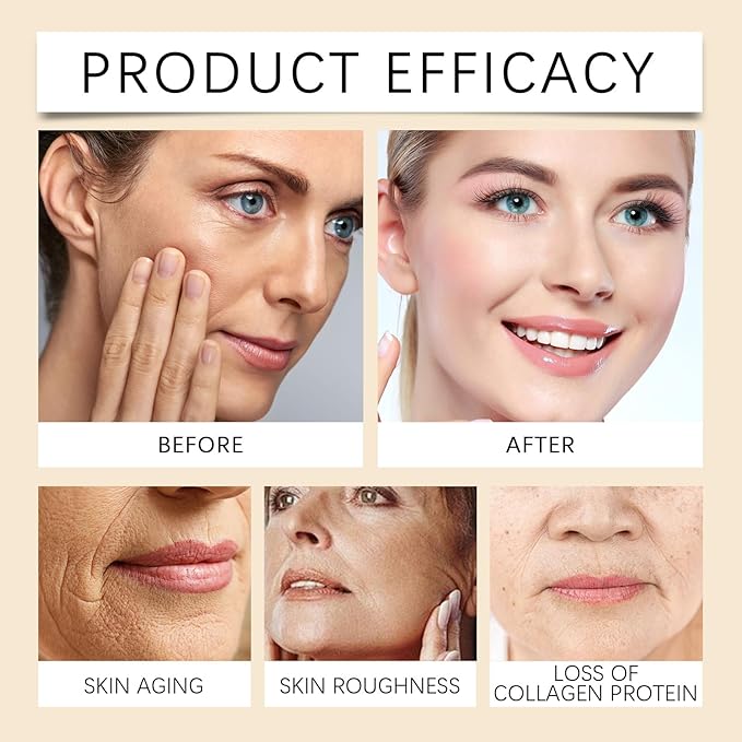 Botox Bee Venom Wrinkle Removal Cream,Anti-Aging Face for All Skin Type Wrinkle Removal & Firming Moisturiser Firming Cream (1)