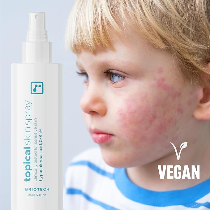 BRIOTECH Topical Skin Spray, Hypochlorous Acid Spray for Sensitive Skin, HOCl Facial Mist, Full Body Support Against Irritation, Calm Redness, Soothe Foot & Scalp, Travel Size 2 oz (2 Pack)