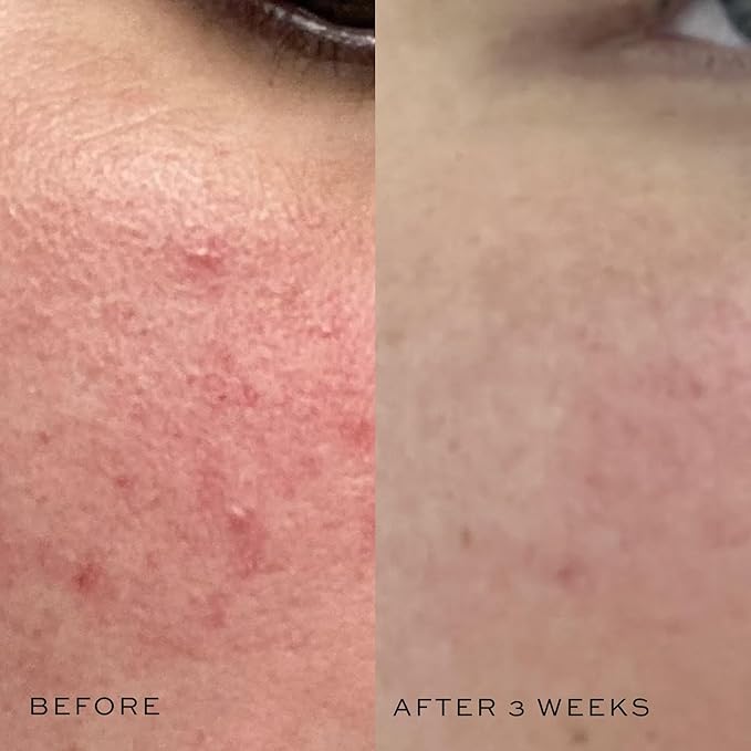 DIME Beauty Mini Super Skin Toner, oz