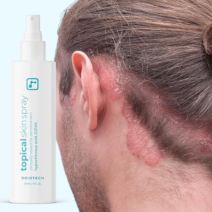 BRIOTECH Topical Skin Spray, Hypochlorous Acid Spray for Sensitive Skin, HOCl Facial Mist, Full Body Support Against Irritation, Calm Redness, Soothe Foot & Scalp, Travel Size 2 oz (2 Pack)