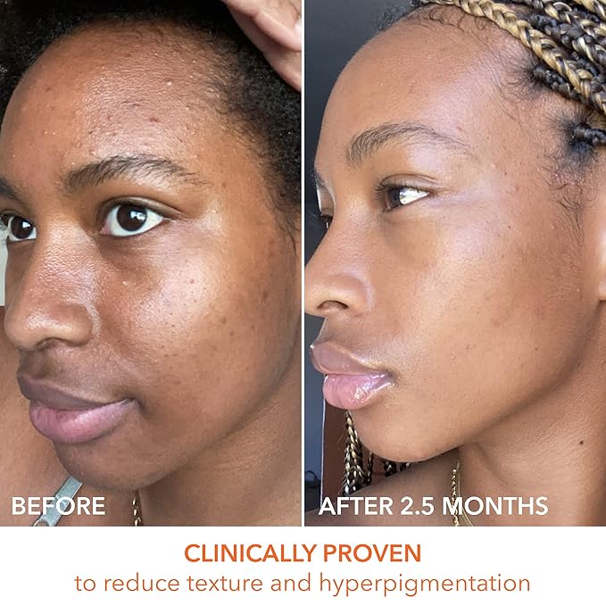 Alpha Beta Universal Daily Peel by Dr. Dennis Gross for Unisex - 60 Pc Pads