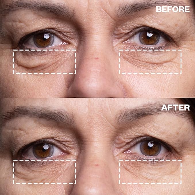 Wrinkles Schminkles Under Eye Wrinkle Starter
