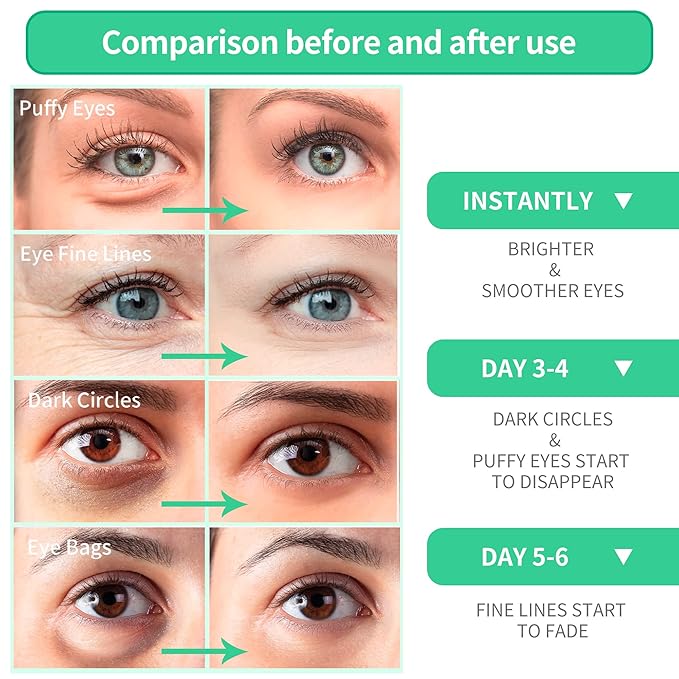 Breylee aloe vera eye masks??60