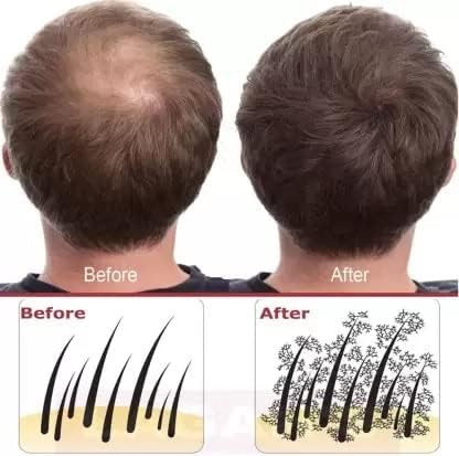 Hair Building Fiber Concealer, m (Natural Black) 28 g