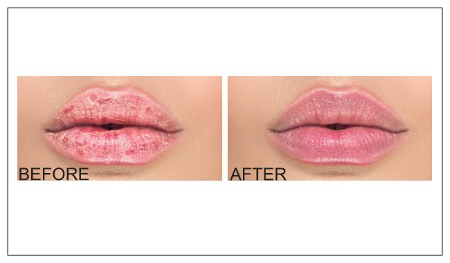 Lip Balm Moisturizer by Sherrin Rosette. Stocking