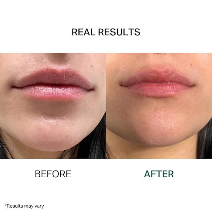 Y’OUR Intensive Lip Balm | Light-Weight Comforting