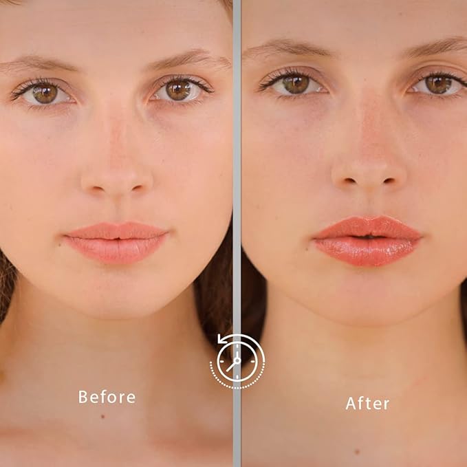 HydroBoost Lip Serum – Hyaluronic Acid oz