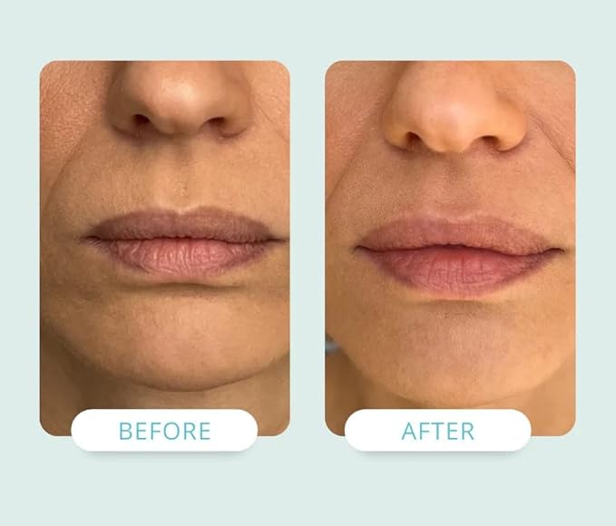 NADIA Lip Renewal Cream with NAD+ ml