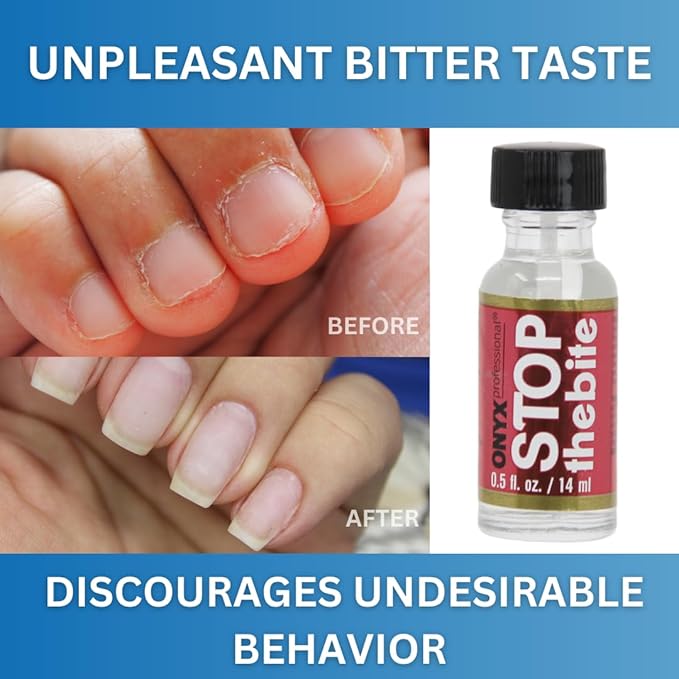 Onyx Professional Stop the Bite