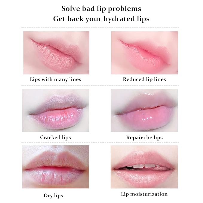 20Pcs Lip Mask, Red Cherry Lip