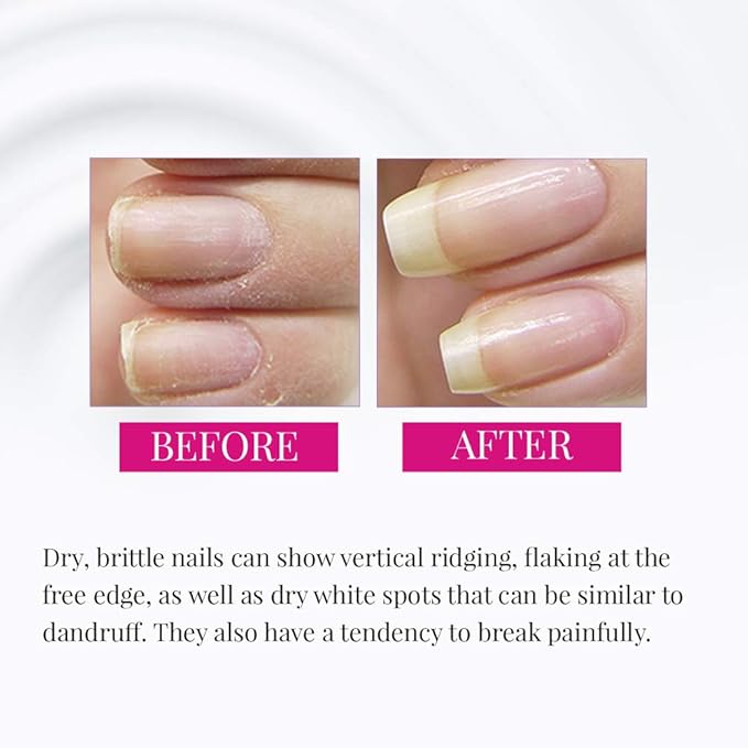 Nail Tek Foundation 3, Ridge