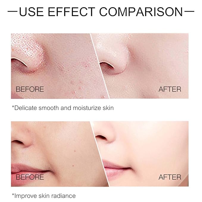 O’KADY Face Skincare Sets Anti Aging