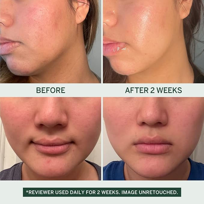 Urban Calm Collection - Fermented Skincare Anti-Aging