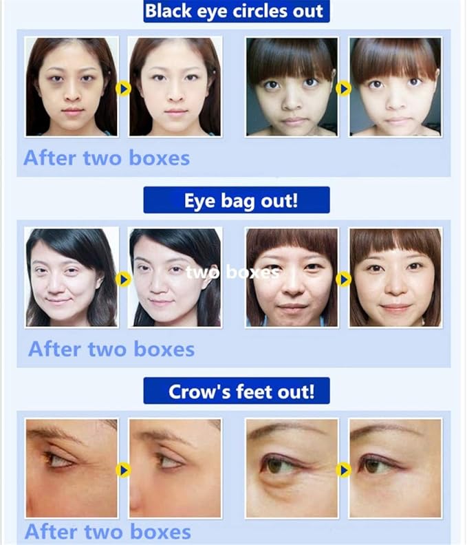 Adofect 30 pairs pink eye