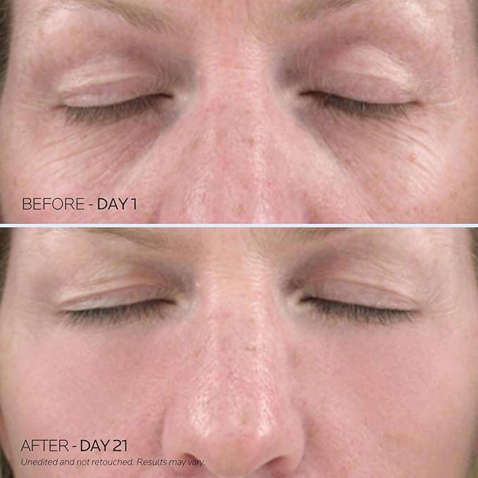 Dr. Pure Under Eye Patches for Puffiness: Retinol Collagen Eye Mask Soothe Fine Lines Wrinkles with Hyaluronic Acid - Reduce Dark Circles Eye Gel Pad (30 Pairs)