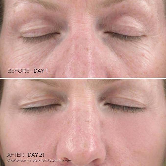 Dr. Pure Under Eye Patches for Puffiness: Caffeine Eye Mask Soothe Fine Lines Wrinkles with Niacinamide Hyaluronic Acid - Reduce Dark Circles Eye Gel Pad (30 Pairs)