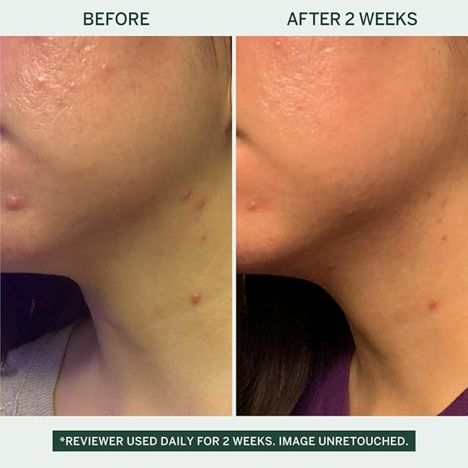 Urban Calm Collection - Fermented Skincare Anti-Aging