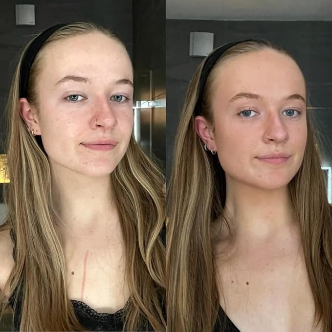 Skinny Tan Tan and Tone Self Tanning Drops for Your Face - Gradual Tan Drops Serum with Hyaluronic Acid - Transforms Skincare into Gradual Tanner - Helps Even Skin Tone and Enhance Complexion - 1 oz