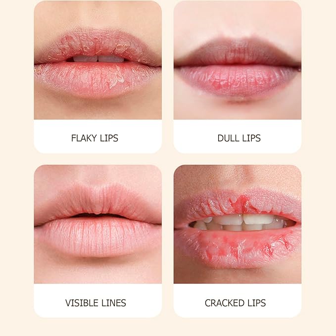 VENZEN Caffeine Moisturizing Tender Lip Cream