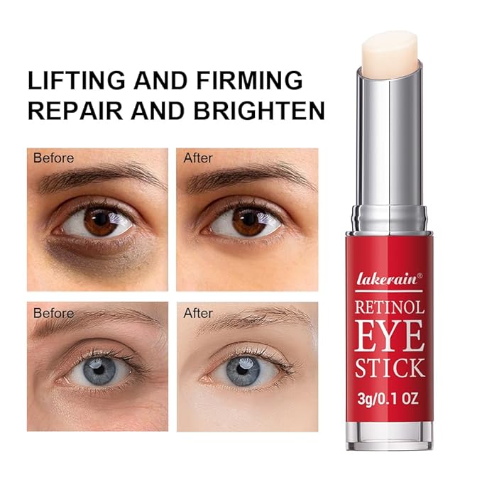 Retinol eye stick-peace out dark