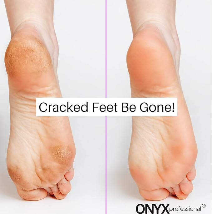 Onyx Professional Gel Moisturizing Socks, One Size Dry Feet Treatment for Women or Men, Hydrating Spa Socks for Dry Feet and Cracked Heel Repair, One Reusable Pair