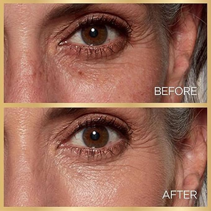 L'Oreal Paris Age Perfect Radiant Serum Foundation with 1 Ounce