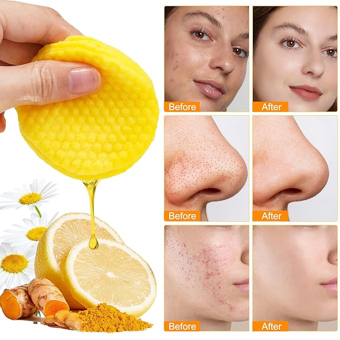 Turmeric kojic acid cleansing pads