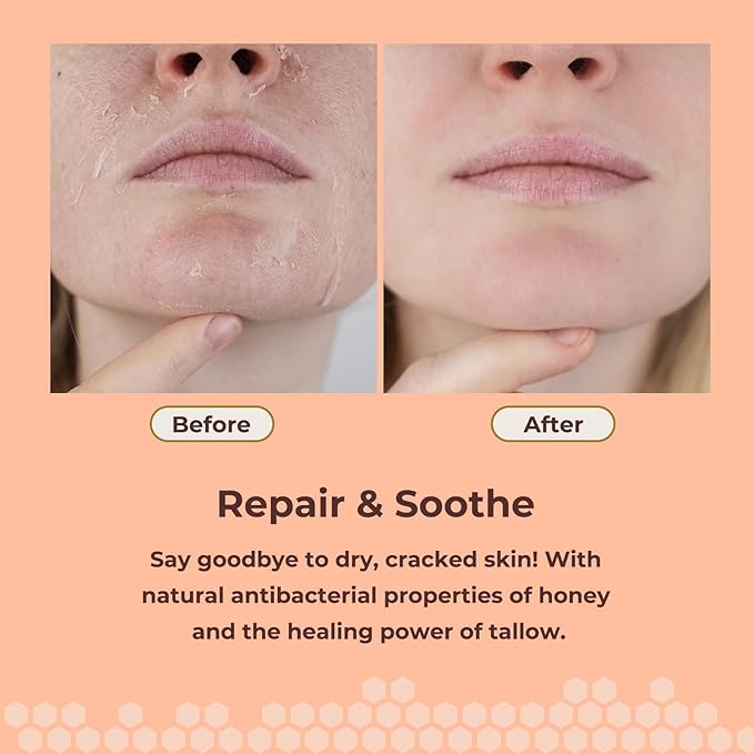 Grass Fed Beef Tallow for Skin Care, Face and Body Moisturizer Cream, Unadulterated Honey, Soothes Dryness, Repairs the Skin Barrier, 2 Oz