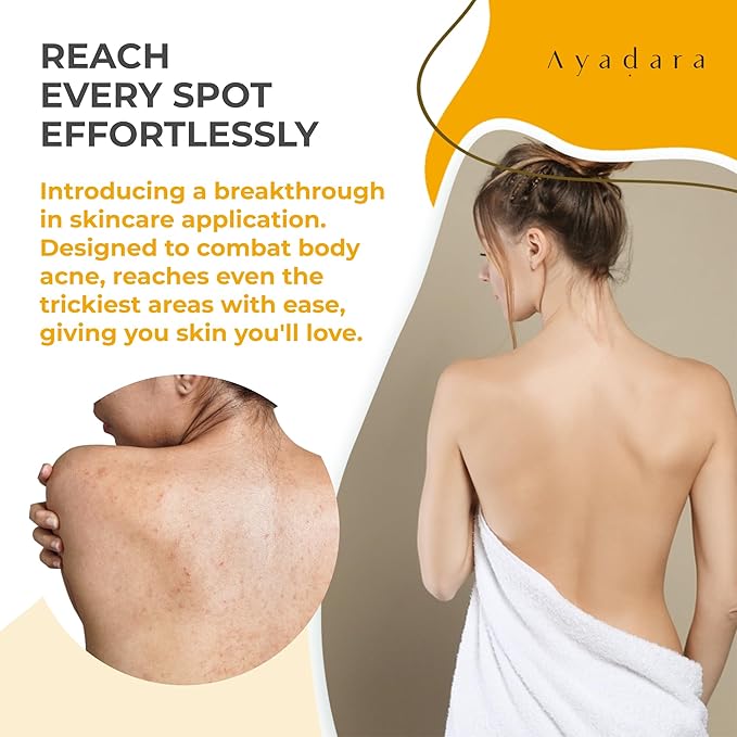 Acne Treatment Body Spray with 2% Salicylic Acid, Tea Tree Scent, for All Hair Types, Soothing and Moisturizing, 3-Pack