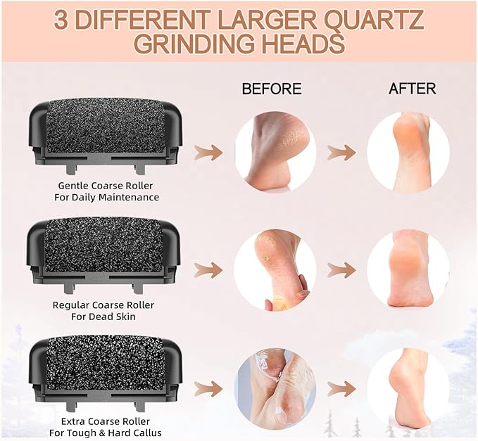 Callus removers 8 pack replacement