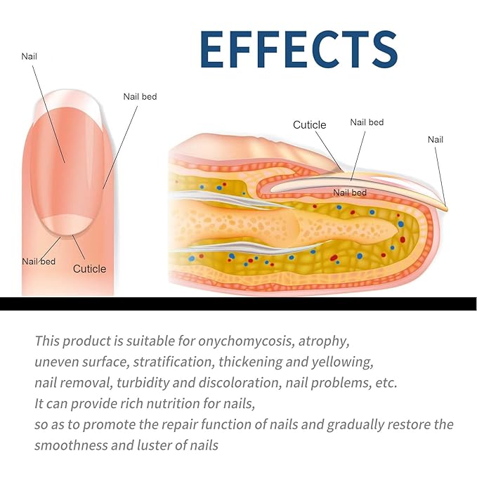 Nail Repair Patches 64 PCS,Nail