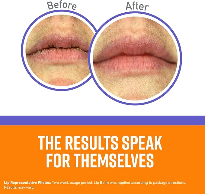 O'Keeffe's Night Treatment Combo Pack Including Working Hands Night Treatment Hand Cream, Healthy Feet Night Treatment Foot Cream and Lip Repair Night Treatment Lip Balm