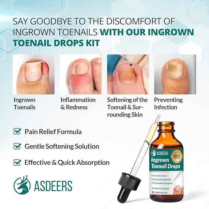 Ingrown toenail treatment: ingrown toenail
