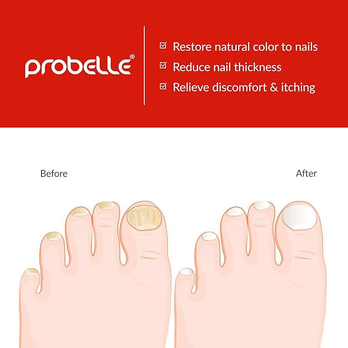 Probelle Natural Fungal Nail Oil,