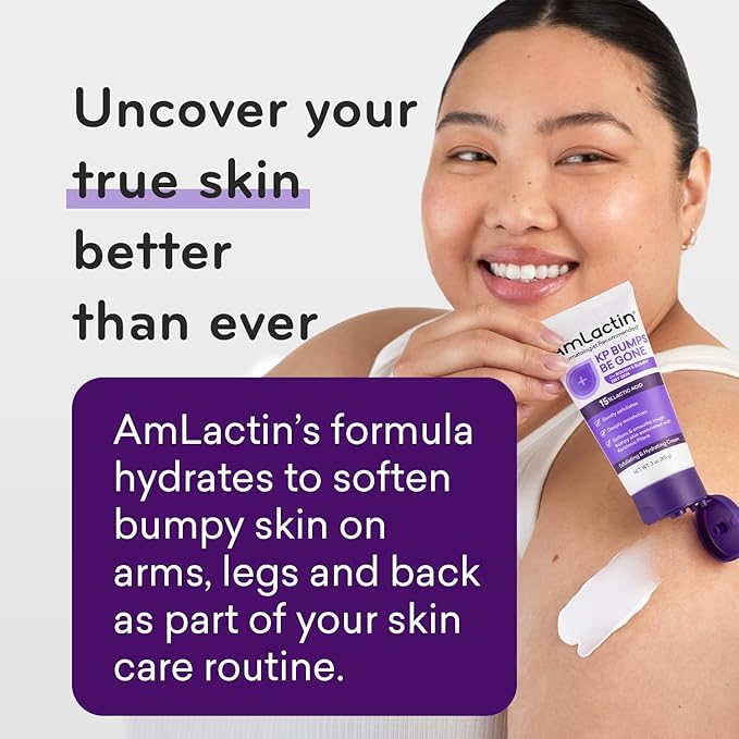 AmLactin KP Bumps Be Gone - 3 oz Keratosis Pilaris Moisturizing Cream with 15% Lactic Acid - Exfoliator and Moisturizer for Dry, Rough and Bumpy Skin, Pack of 2 (Packaging May Vary)