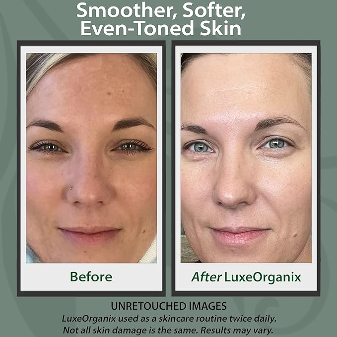 Organic Vitamin C Face Moisturizer with Anti-Aging, Brightening, and Wrinkle-Smoothing Properties.