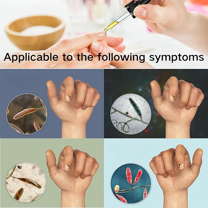 Ginger Nail Treatment, Nail Treatment,