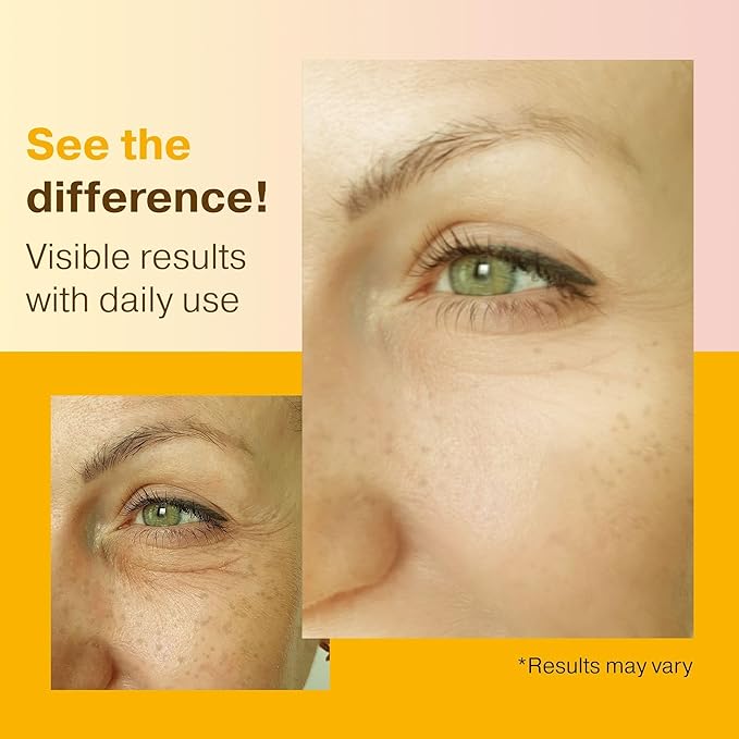 Double Size (2OZ) Super Vitamin C Serum for Face w/Niacinamide Serum, 5% Vitamin C Face Serum w/Hyaluronic Acid, Resveratrol, Anti-Aging Brightening Super C Serum, Facial Serum Vitamina C, E