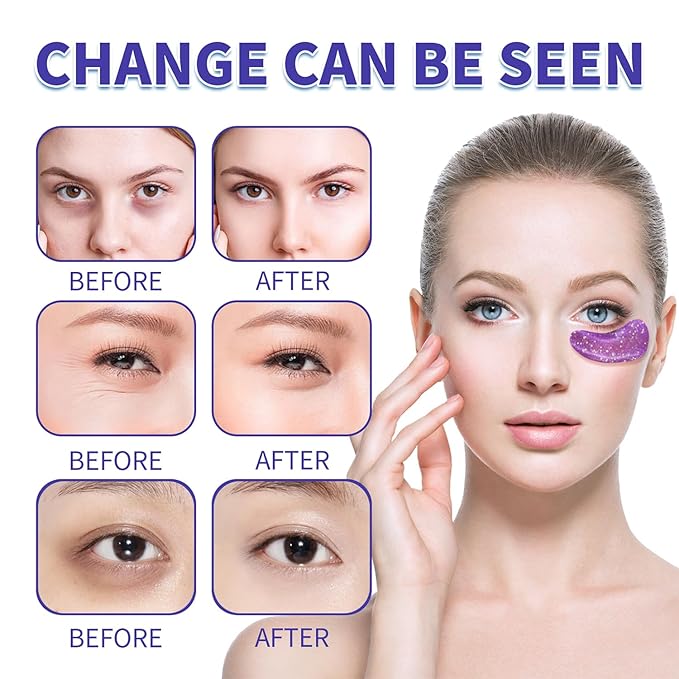 Under eye patches (28 pairs)