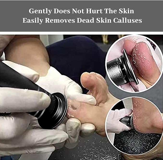 Upgrade Electronic Foot File Grinder