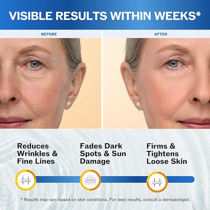 LilyAna Naturals Retinol Cream - Anti-Aging Moisturizer for Face & Neck, Made in USA, Wrinkle Reduction - 1.7oz, 2 Pack