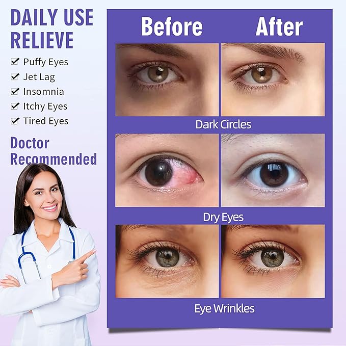 Serfeymi 22 packs steam eye